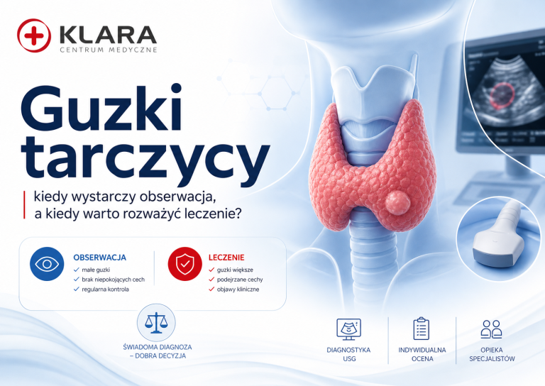 Guzki tarczycy – kiedy wystarczy obserwacja, a kiedy warto rozważyć leczenie?