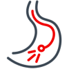 endoskopia